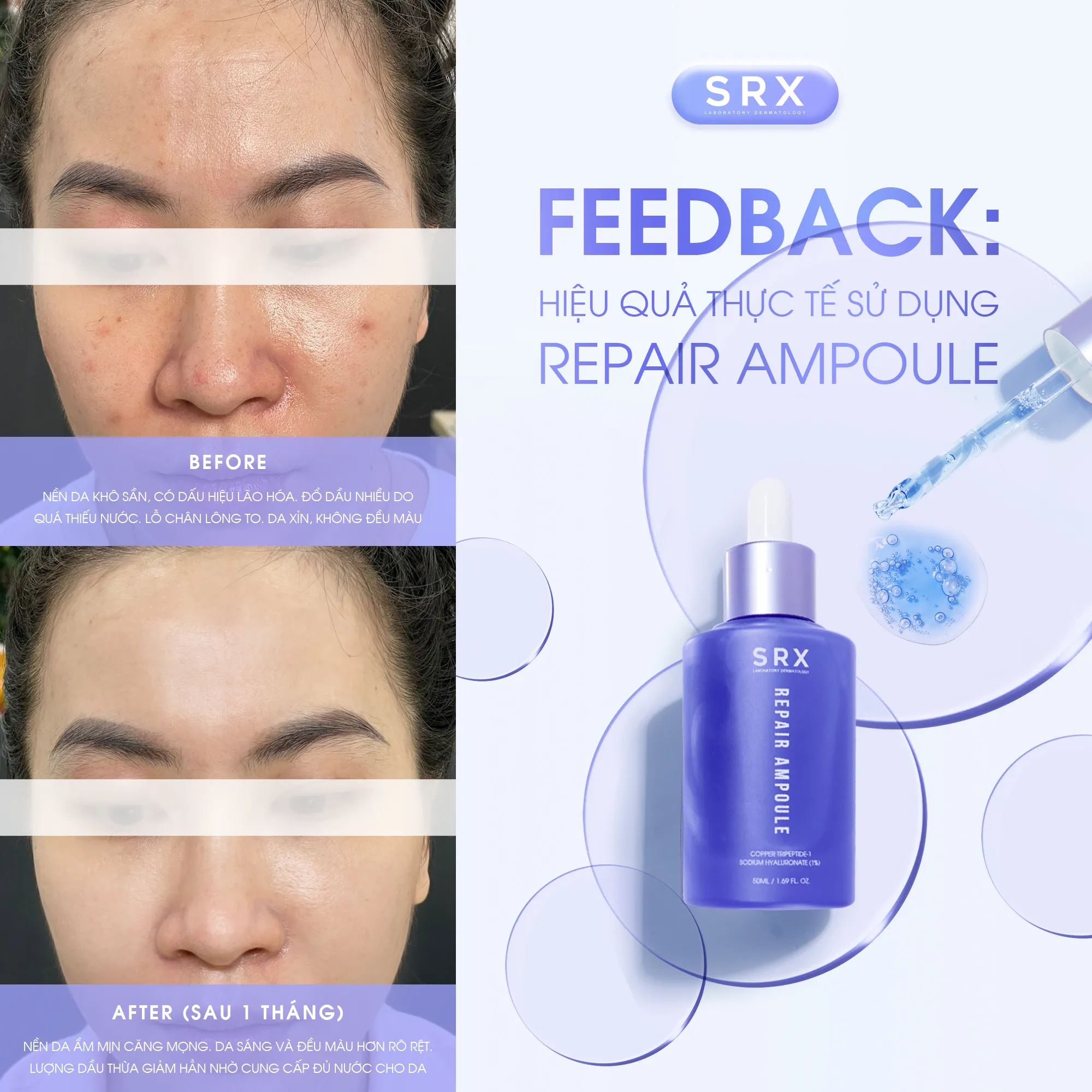 Feedback SRX FEEDBACK CHỈ 1 THÁNG DA CĂNG MỌNG, SÁNG RÕ RỆT CÙNG SRX REPAIR AMPOULE