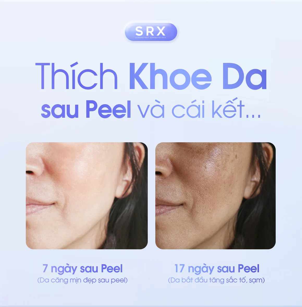 Feedback SRX THÍCH KHOE DA SAU PEEL VÀ CÁI KẾT