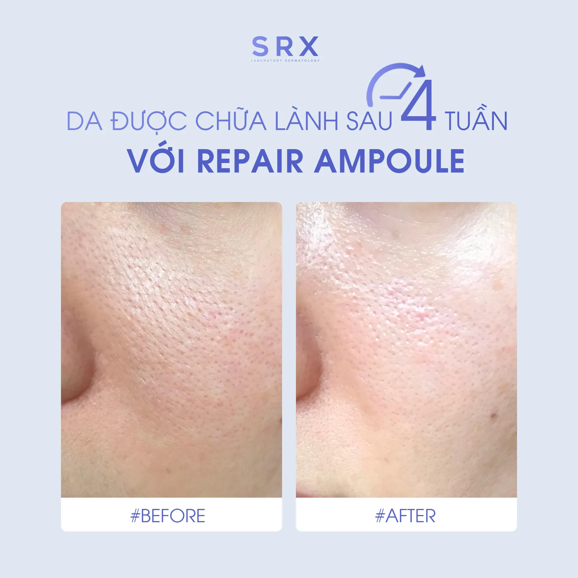 Feedback SRX web fb 2